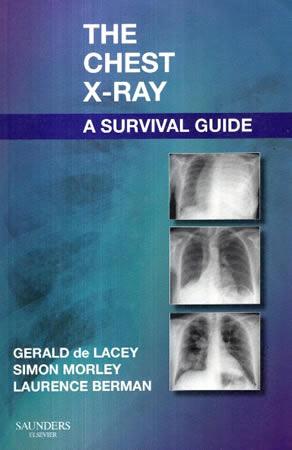 THE CHEST XRAY