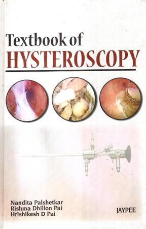 TEXTBOOK OF HYSTEROSCOPY