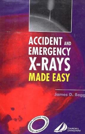ACCIDENT AND EMERGENCY X-RAYS MADE EASY